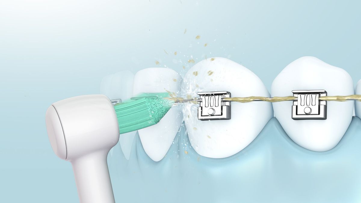 Panasonic Ersatzdüse WEW0984 (2)