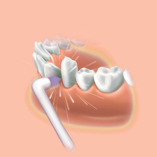 Panasonic Zapfenbürste EW0940